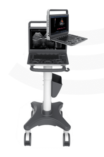 Ultraschallgerät Sonoscape E1 / E2